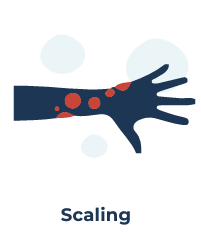 Scaling