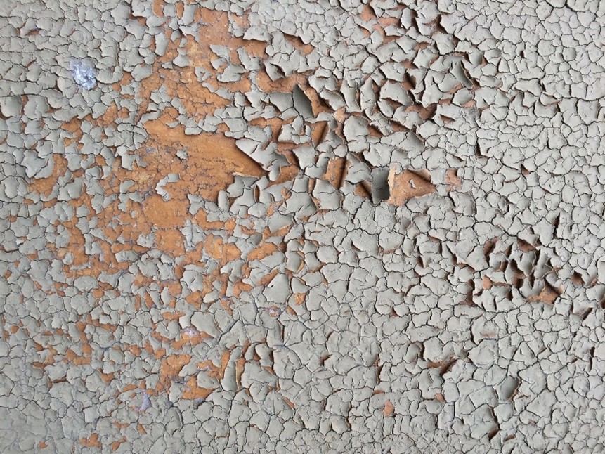 Lianne: Was tun bei einem Psoriasis-Schub?
